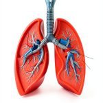 Lung Cancer Guide Kindle Edition Amazon Book-0