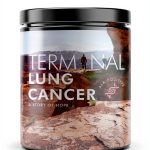 Lung Cancer Guide Kindle Edition by WGS Comprehensive 257‑Page eBook-0