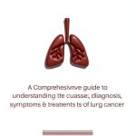 Lung Cancer Essentials Kindle eBook by Medical Insights 31 Page Guide-0
